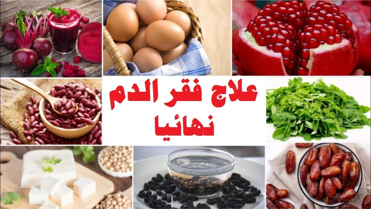 علاج فقر الدم