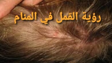 القمل في المنام